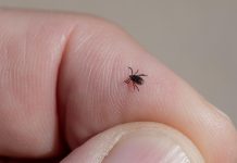 Ugriz krpelja nije bezazlen: Stručnjaci upozoravaju na čestu pogrešku pri uklanjanju